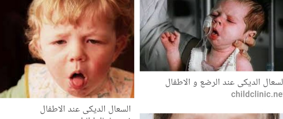default image