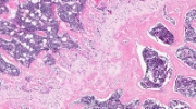 default image
