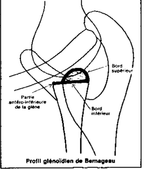 default image