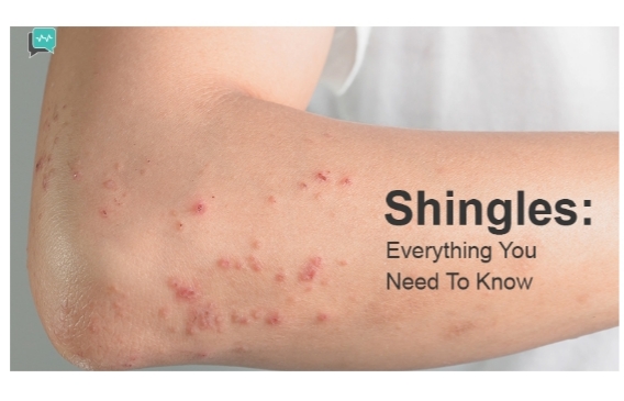 تم نشر مقالة علمية للتدريسيه في قسم تقنيات التخدير الدكتورة رشا فاضل عبيد بعنوانShingles 