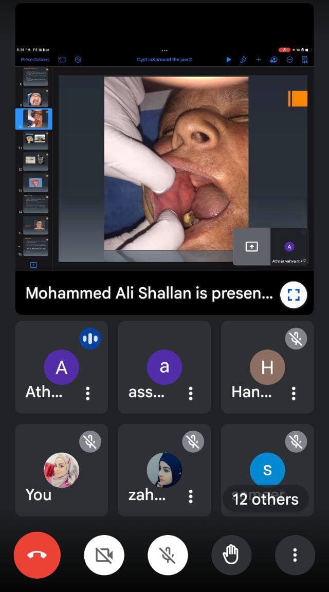 default image