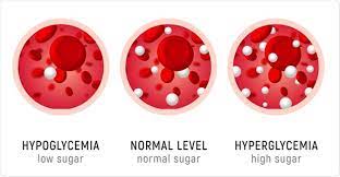 تم نشر مقالة علمية للتدريسية (م.م. نور قحطان صبري بعنوان DIABETES