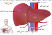 Hepatitis