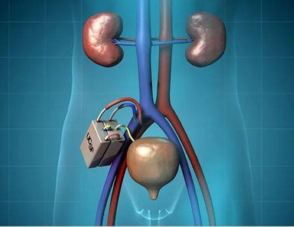 مقال للتدريسية في قسم هندسة الطب الحياتي الدكتورة (م.د. قبس خالد ناجي ) بعنوان (الكلى الصناعية.. ثورة في عالم الطب)