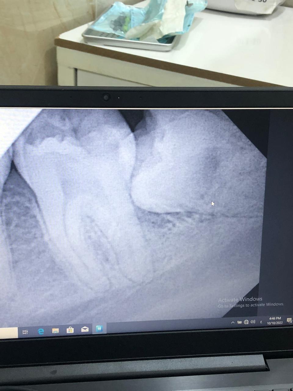 default image