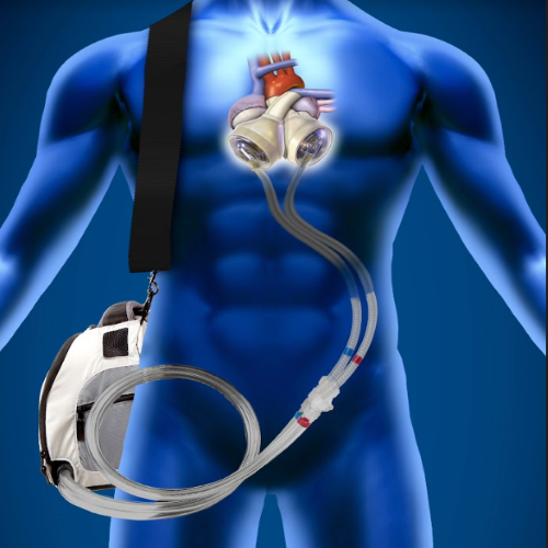 Artificial Heart 