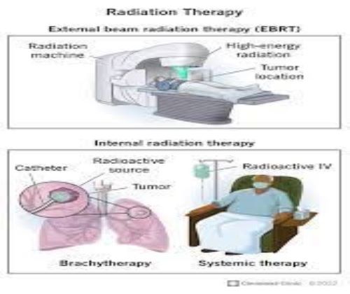 يقيم قسم هندسة الطب الحياتي ندوة علمية عن العلاج الأشعاعي و أنواعه 