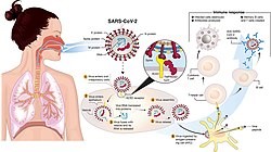 COVID-19 And The Risk Of Pulmonary Venous Thromboembolism