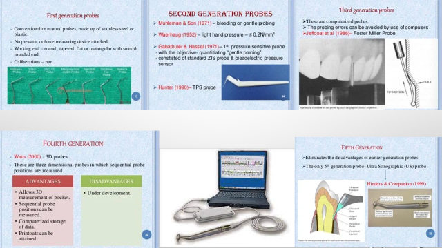 قسم طب الأسنان يقيم سمنار علمي بعنوان "periodontal pocket  " 