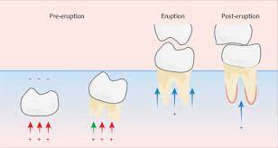 أقامة ندوه علمية ألكترونيه للدكتوره عذراء يحيى محمد الحجازي بعنوان .Eruption of teeth, Mechanism of eruption 