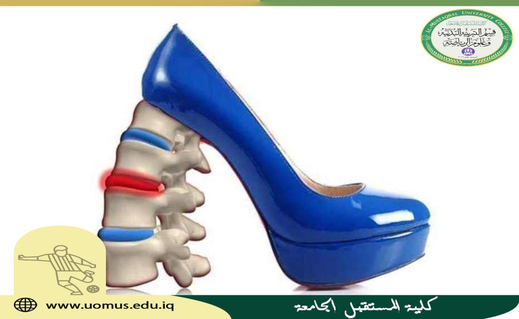 مقالة  للتدريسية (م.د افتخار مطر باقر )  تتحدث فيها عن أضرار_الكعب_العالي