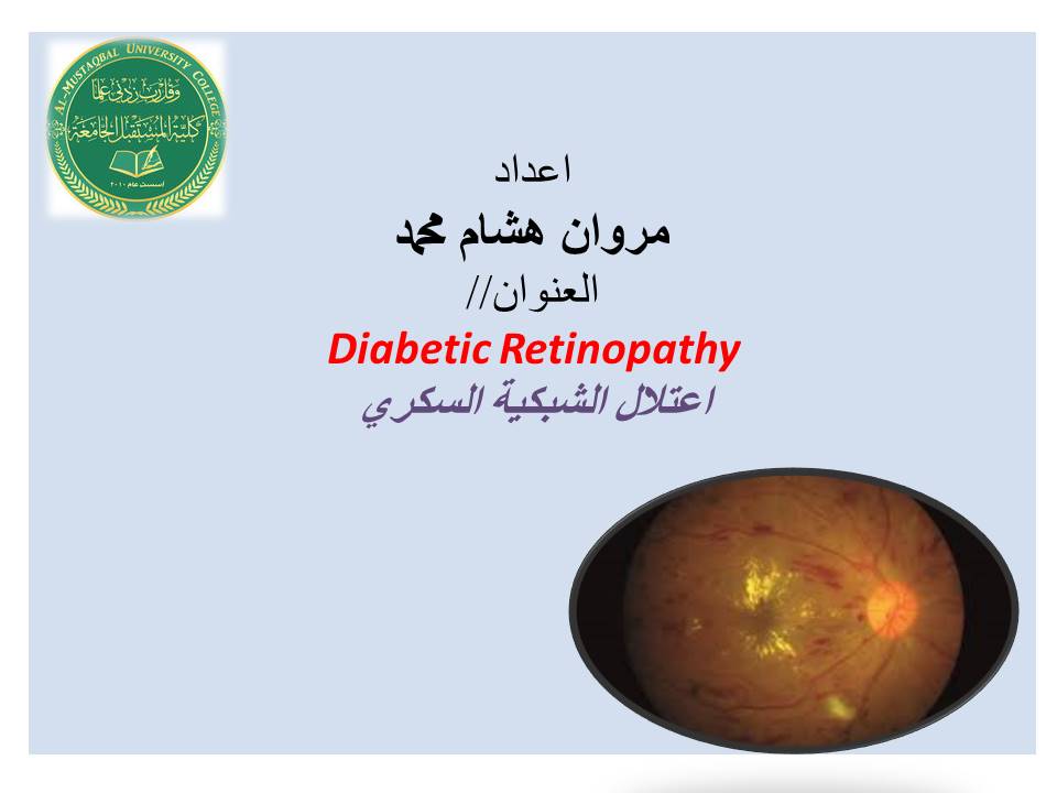 ورشه علمية الكترونية بعنوان (اعتلال الشبكية السكري)