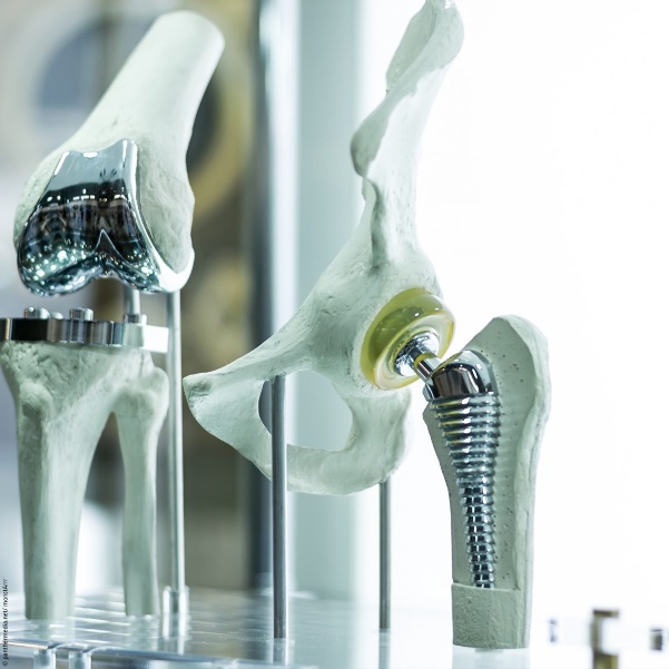 Types of corrosion in orthopedic applications
