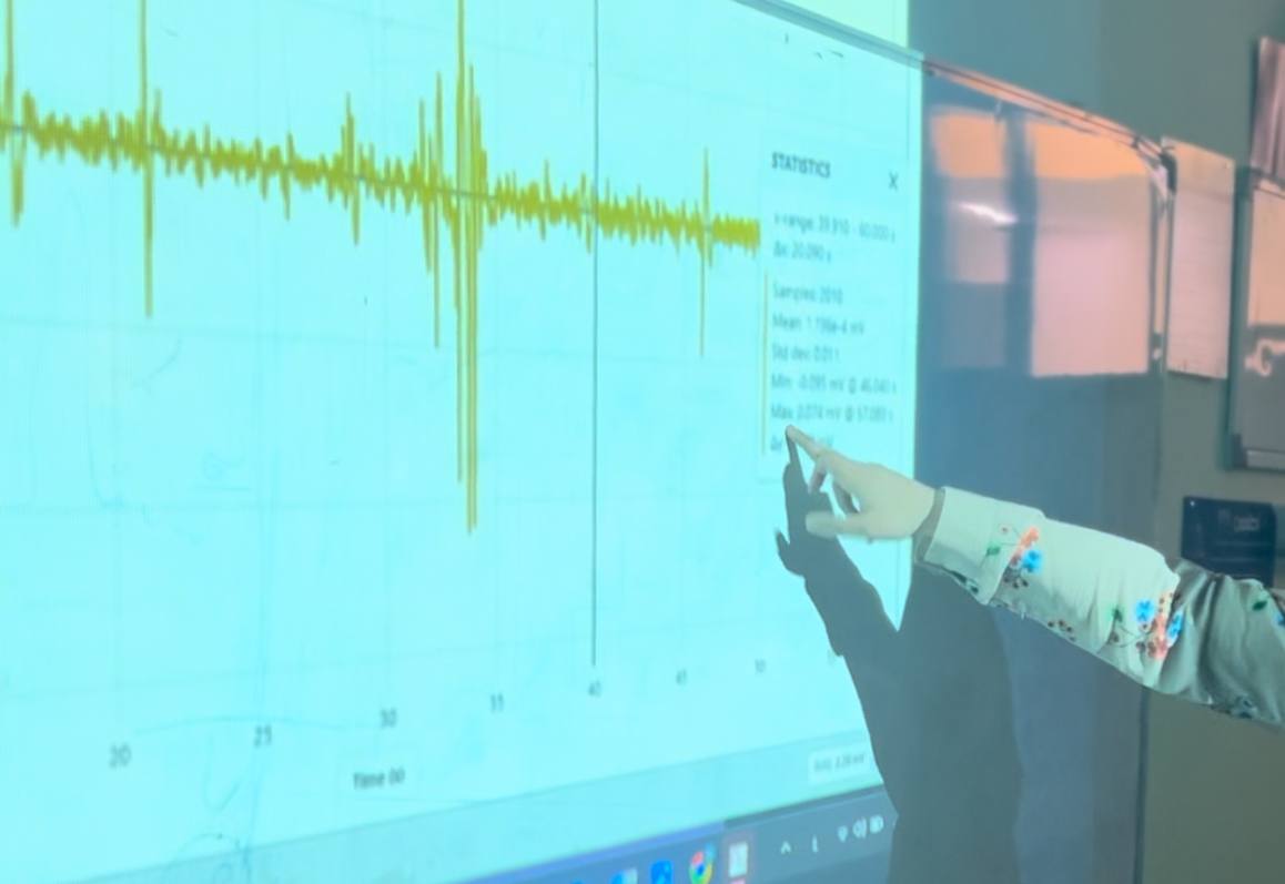 ورشة" جهاز تخطيط العضلات (EMG)"