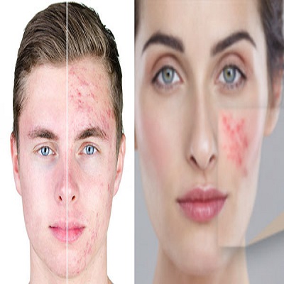 default image
