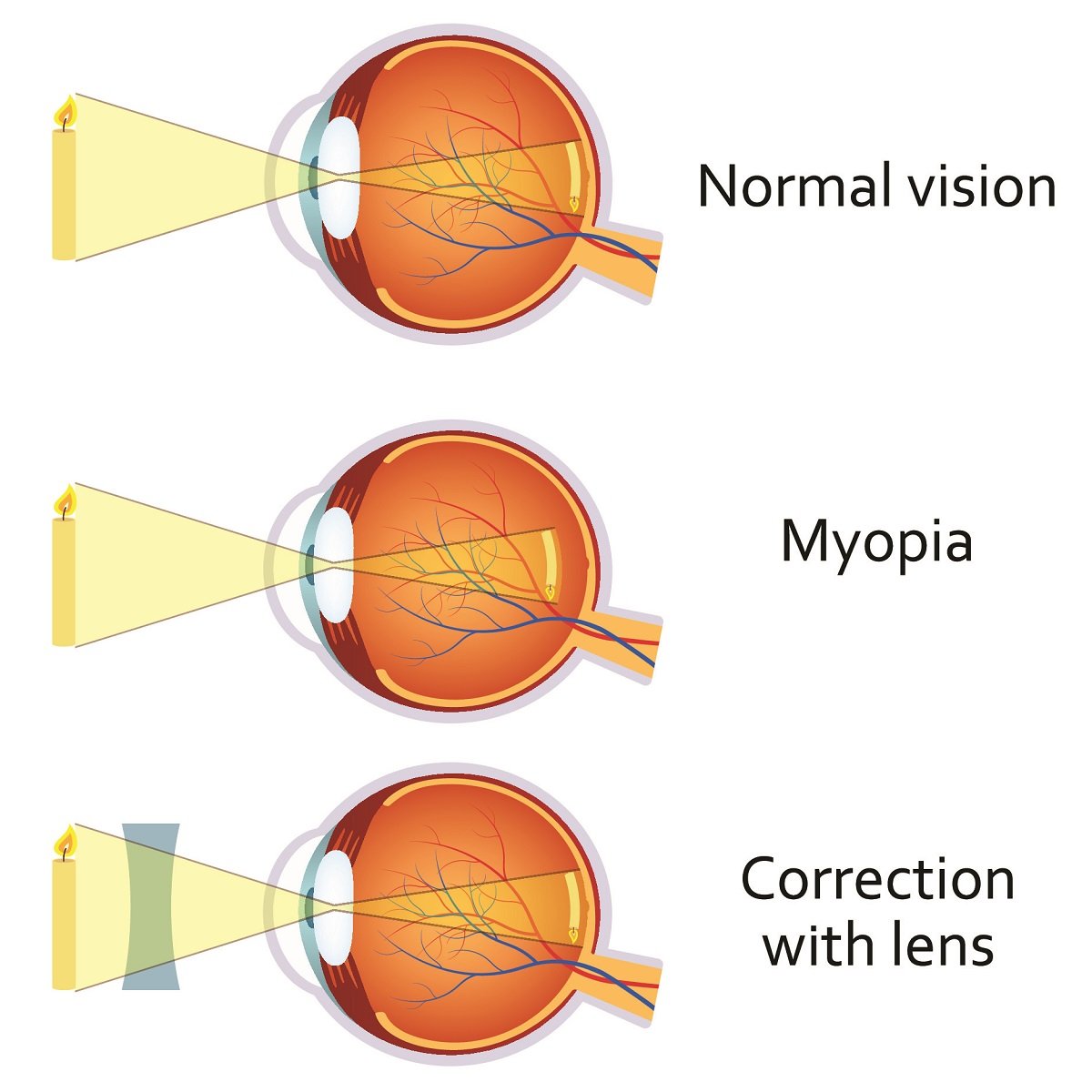 default image