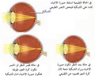 default image