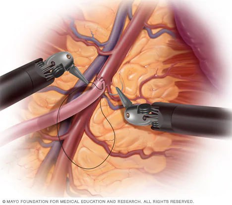 حلقة نقاشية بعنوان"robotic surgery"