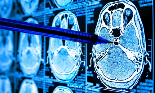 The article by Dr.Maytham N. Meqdad titled "The Importance of Using the Artificial Intelligence Technique CNN in Breast Cancer Diagnosis"
