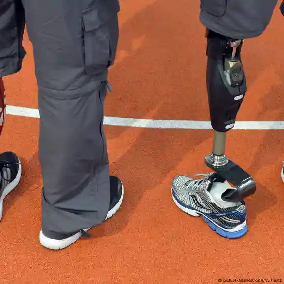 A prosthetic limb that can see the latest developments in prosthetic limb manufacturing.