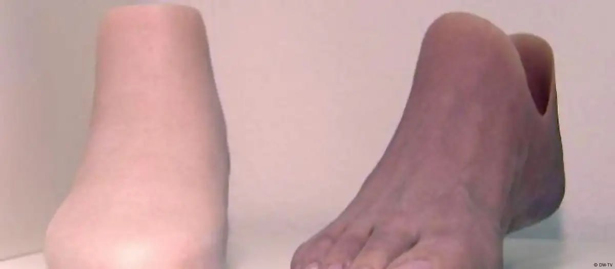 the ancient Egyptians' skill in designing prosthetic limbs.