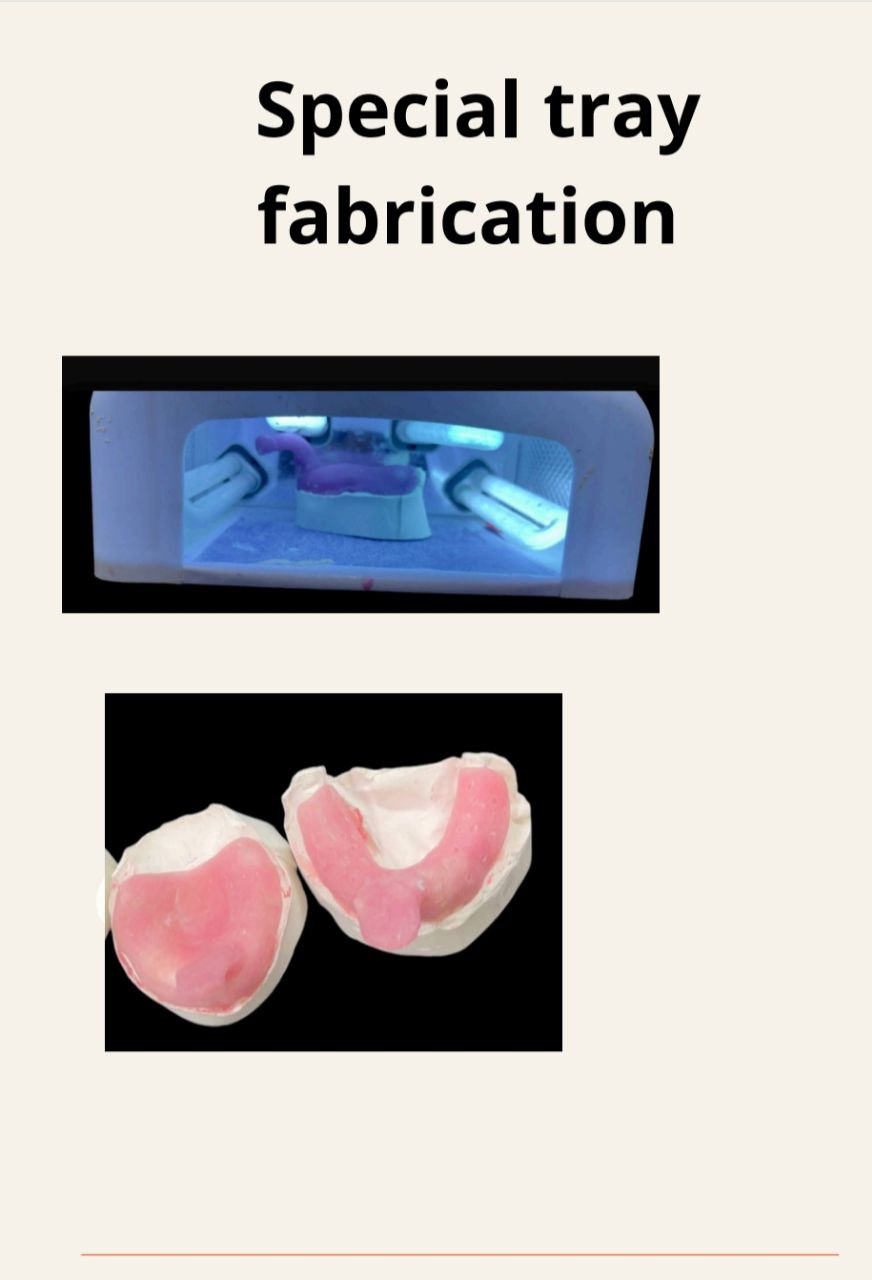 default image