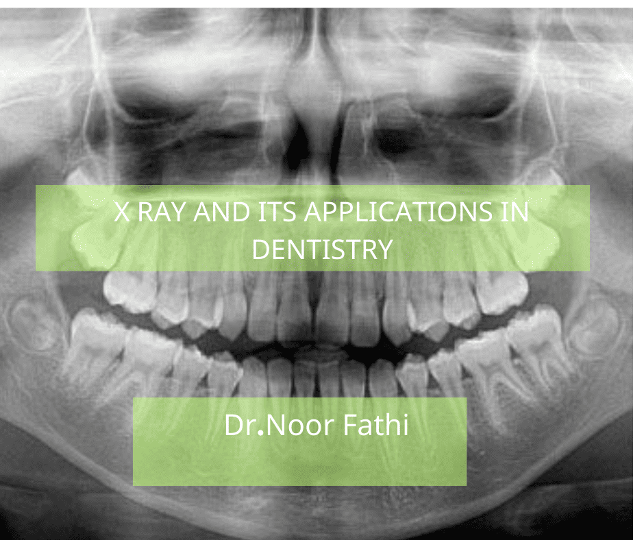 مقالة علمية للدكتورة نور فتحي بعنوان "X ray and its applications in dentistry "