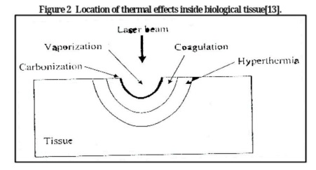 The Nagative Effect of LASER Radiation on human body Blood Viscosity  BY PH.D Raad Shaker Alnayli