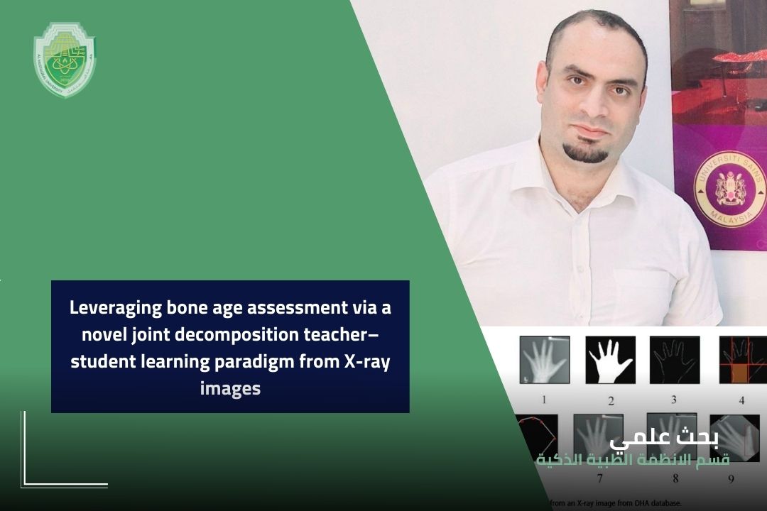 نشر الدكتور ميثم نبيل مقداد مقررقسم الانظمة الطبية الذكية في كلية العلوم بجامعة المستقبل البحث الموسوم  Leveraging bone age assessment via a novel joint decomposition teacher–student learning paradigm from X-ray images
