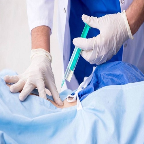 Cesarean Section with TAP Blocks