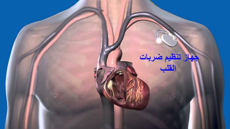 مقالة علمية بعنوان "جهاز تنظيم ضربات القلب" للطالب (امير عصام كردي)–كلية العلوم– قسم علوم الفيزياء الطبية–المرحلة الثالثه– كروب H وباشراف (م.م علي جعفر عبيد) 