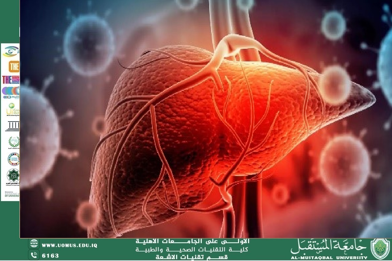 مقالة بعنوان : التهاب الكبد الفيروسي للدكتور فاضل صاحب الحسناوي 