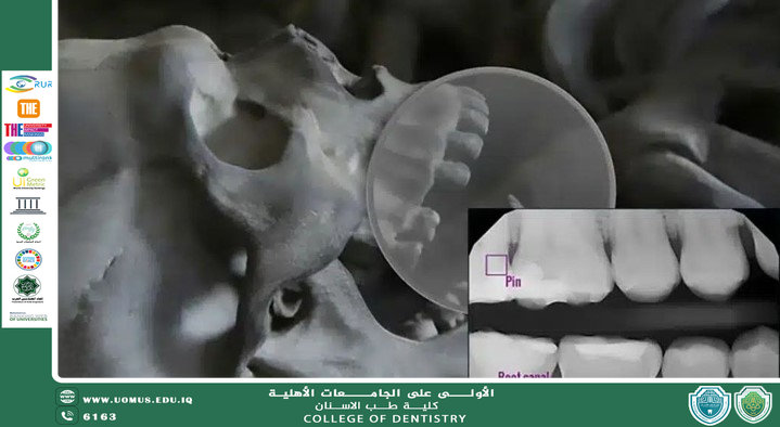 Forensic dentistry and dental radiology