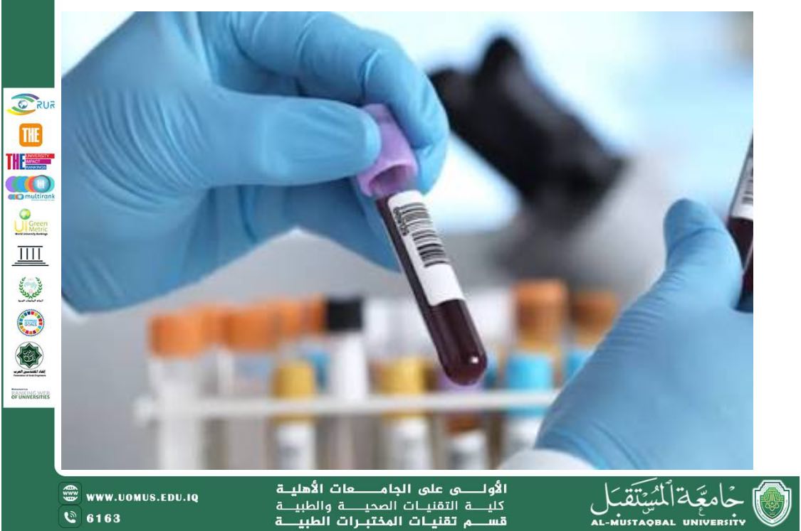 مقالة علمية للدكتور حيدر حليم سعيد بعنوان : علاقة بكتريا ال Strept pyogenes ب تسبب أصابه ال ASO يسبب التهاب المفاصل الرثوي