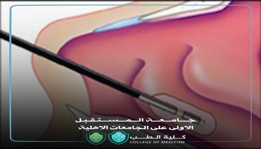 Article on the Use of Coblation Surgery in Treating Allergic Rhinitis