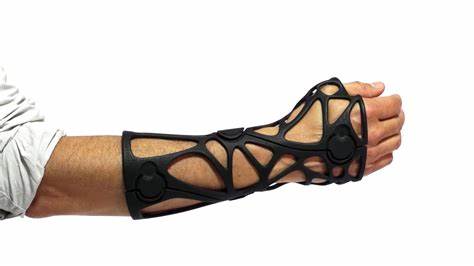 3D Printing and Its Role in the Development of Orthotic Supports in Medical Applications