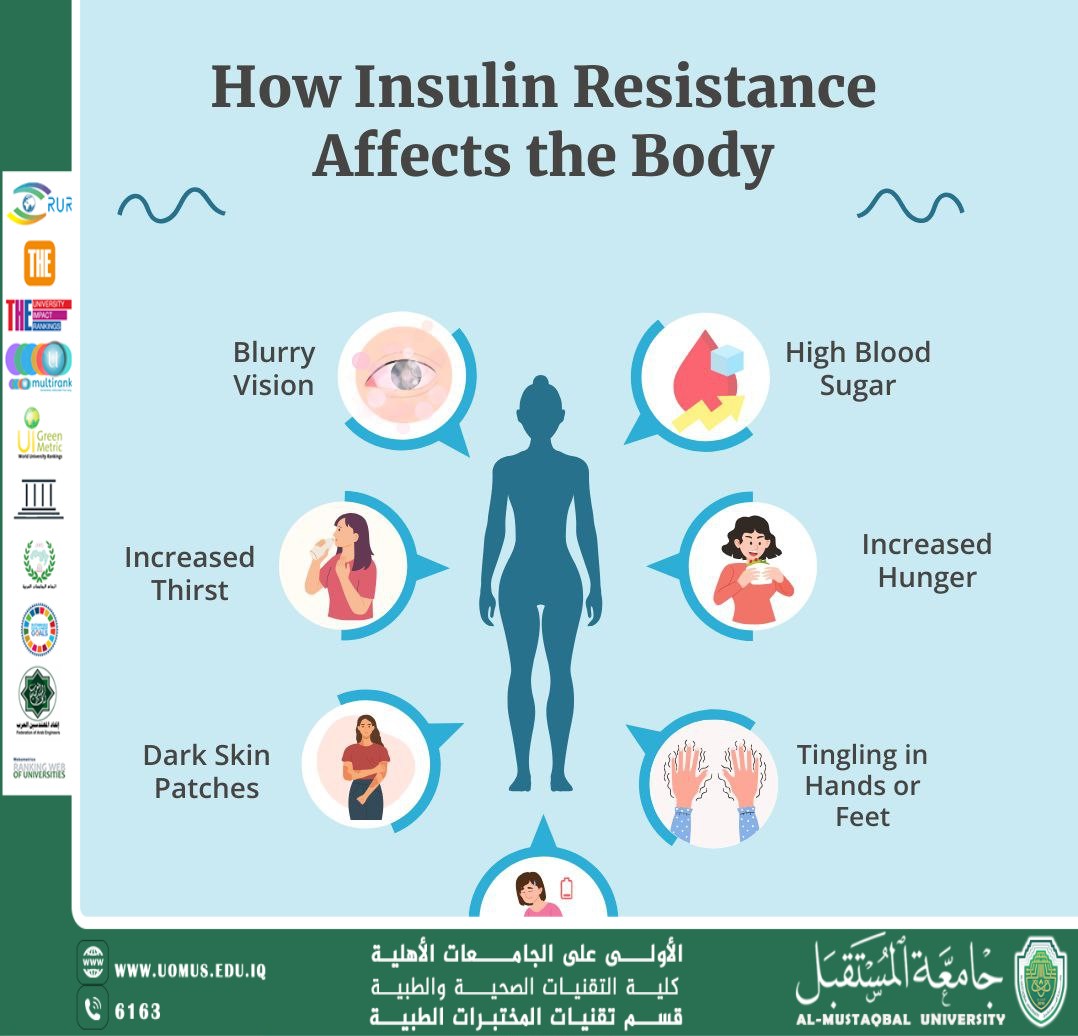  Understanding Insulin Resistance: Causes, Symptoms, and Managementمقالة علمية للمدرس الدكتورة داليا شاكر بعنوان