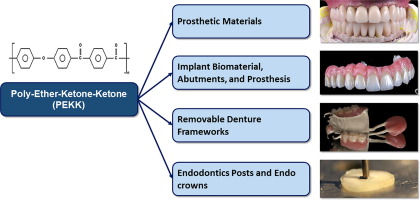 Scientific article entitled  What is PEEK used for in dentistry?