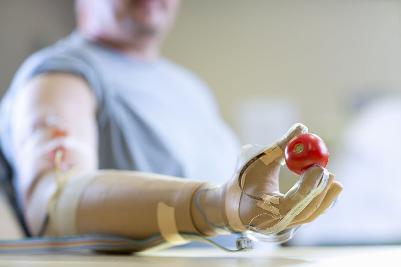 Prosthetic Limbs and Their Impact on Mental Health
