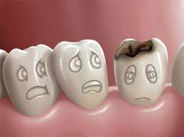Scientific article entitled germ in teeth