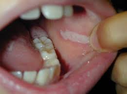 Scientific article entitled   Cheek Biting  