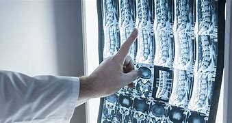 Medical Imaging and Its Importance in Diagnosis and Treatment ( Dr. Maytham Nabil Miqdad).