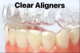 Clear aligners
