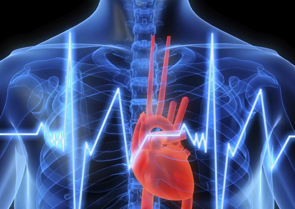 مقاله علمية لطبيبة الاسنان الدكتوره نور مهند عباس بعنوان angina pectoris
