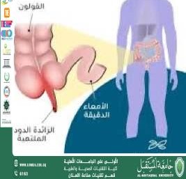 The appendix: its function, causes of inflammation and treatment