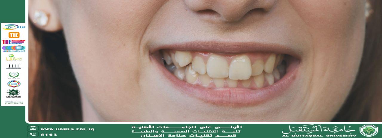 Dental Crowding