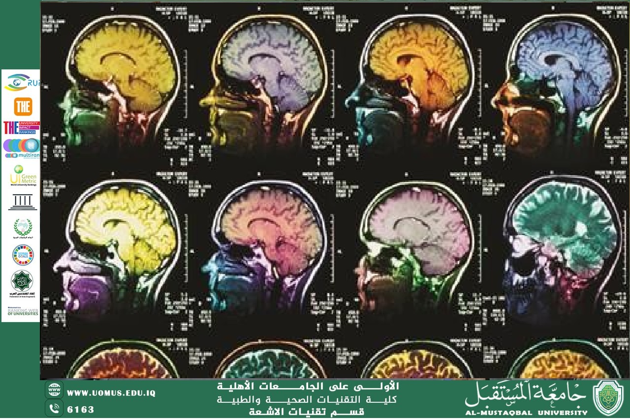 An article entitled "The Role of Nanotechnology in Improving Contrast Agents in Magnetic Resonance Imaging" by Assistant Professor Dhurgham Yousef Al-Hamdani