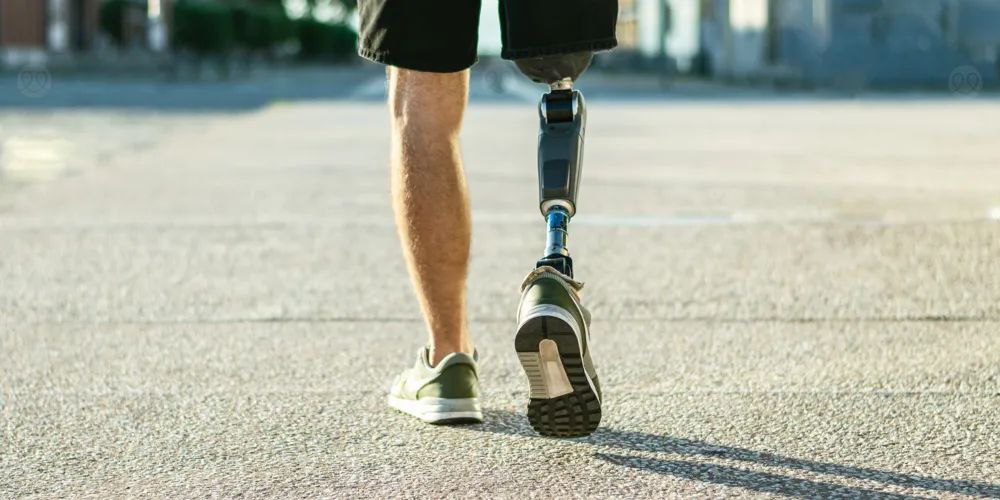 مقالة علمية بعنوان"  الاعتناء بالأطراف الصناعية  أهمية العناية لضمان الأداء الأمثل" للمهندسة براء صالح مهدي 