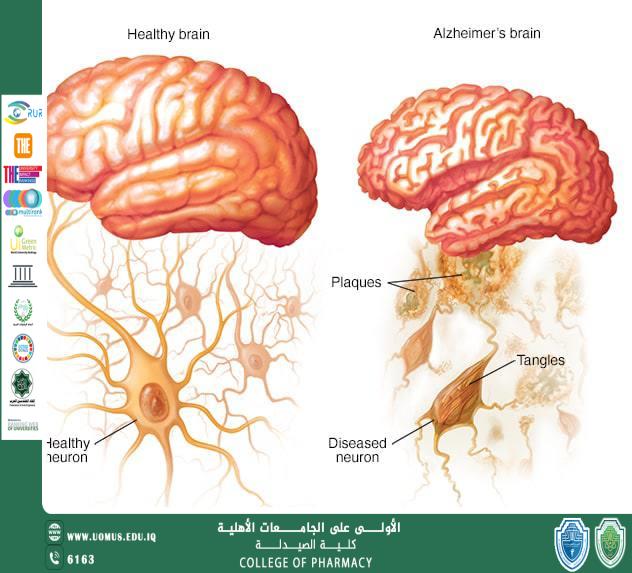 مقالة لسفير الأستدامة الطالب عبدالله وهاب علاوي المرحلة الثانية 