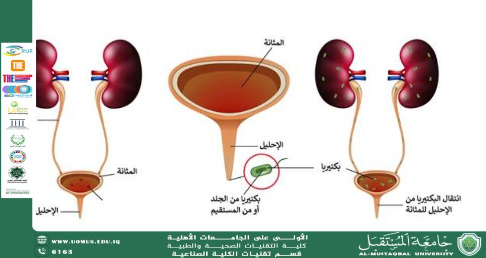 Bacteria Causing Kidney Failure Diseases